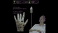 不気味な感染症特定シム『Symptoms of Infection』早期アクセス開始 Feat 9670a69cd867 120x68